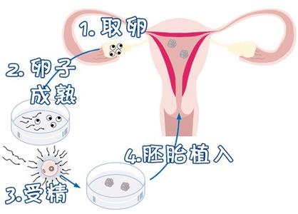关于同志借卵代怀咨询哪家好